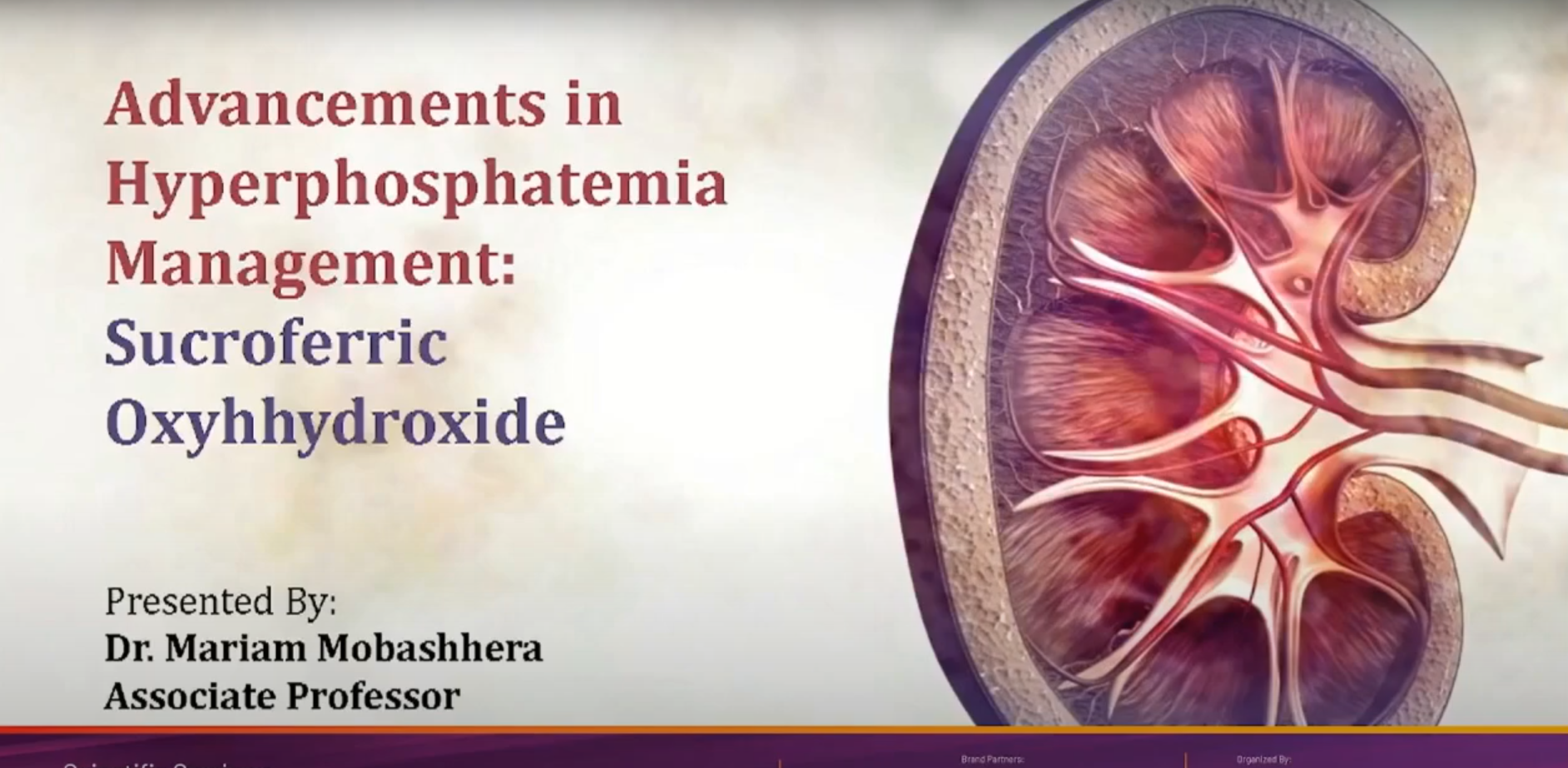 Breakthrough in Management of Hyperphosphatemia: Sucroferric Oxyhydroxide By Dr. Mariam Mobashhera