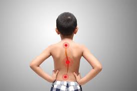 Back Discomfort in a 12-Year-Old Boy