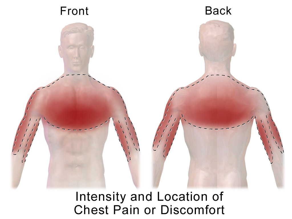 Dyspnea and Back Pain in a 24-yr-old Man