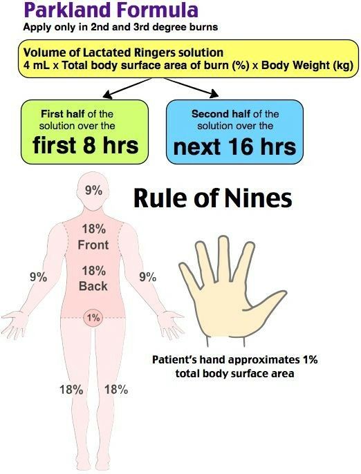 Rules of Nine: Burn Patient Management