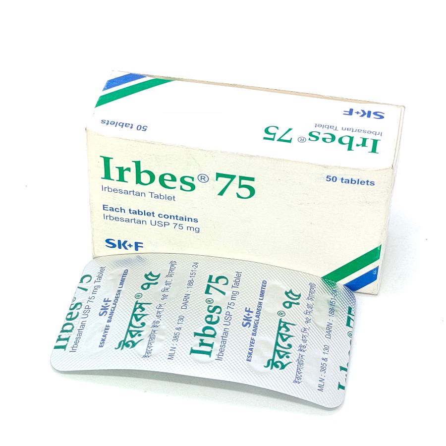 Irbes